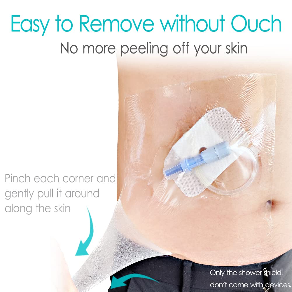 Hola Health peritoneal dialysis catheter cover protects the chest during showers