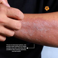 Citrus fragrance of Honey for Healing cream enhances skincare routine