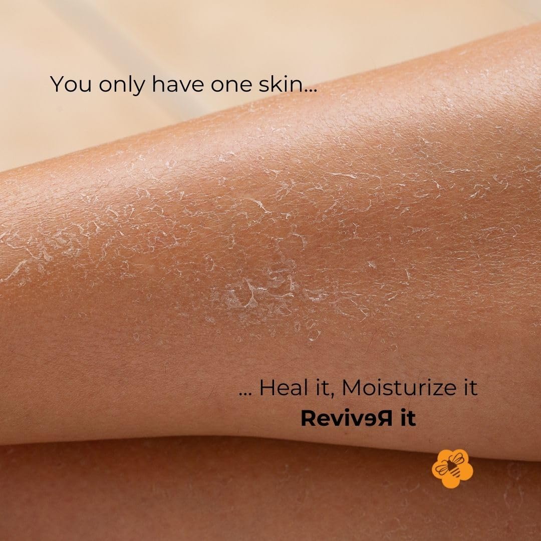 Cream nourishing extremely dry skin areas like elbows and feet