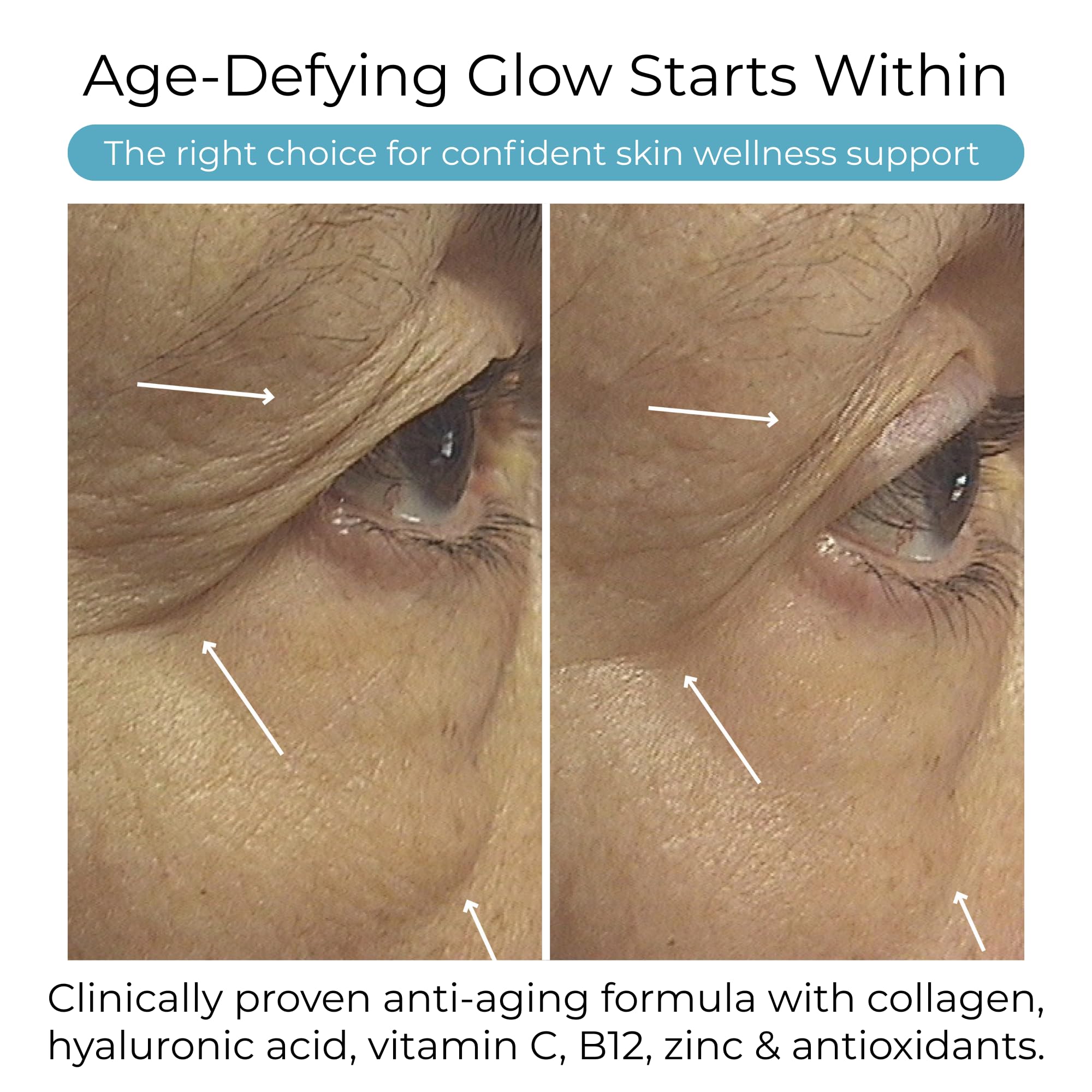 Hush & Hush tablets on white surface emphasize moisture retention from hyaluronic acid.