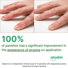 HVSun Atoskin eczema cream applied to forearm for daily care.