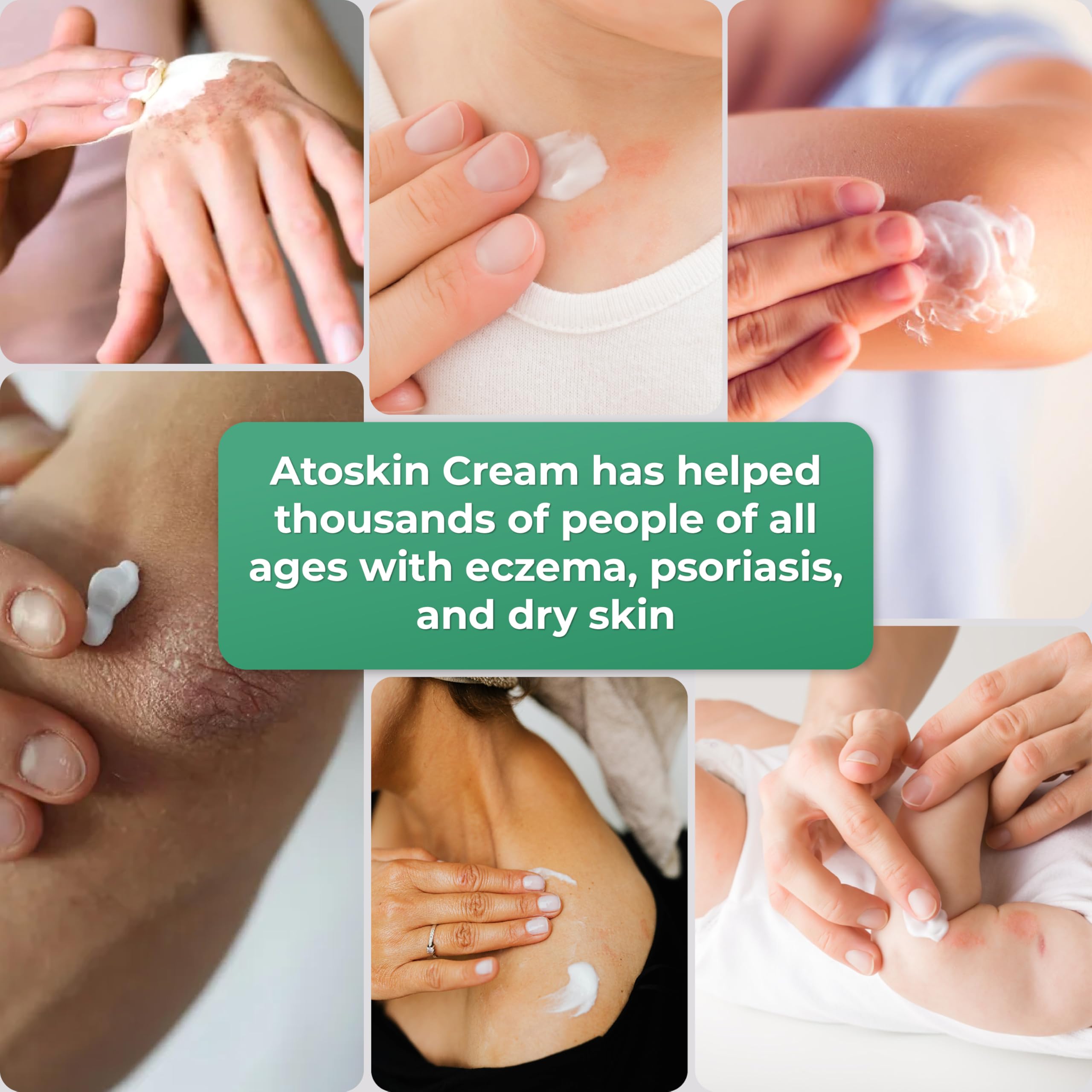 HVSun Atoskin Cream supports daily skincare with a soothing touch