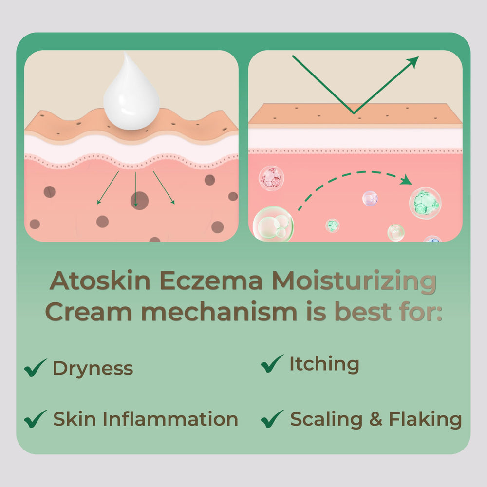 HVSun Atoskin Cream provides calming relief on irritated skin
