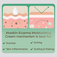 HVSun Atoskin Cream provides calming relief on irritated skin
