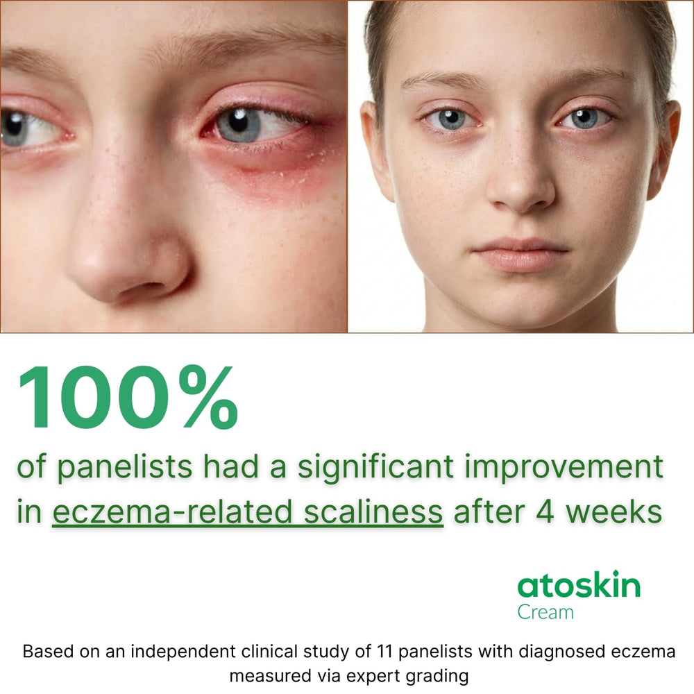 HVSun Atoskin Cream suitable for kids and adults seeking gentle care