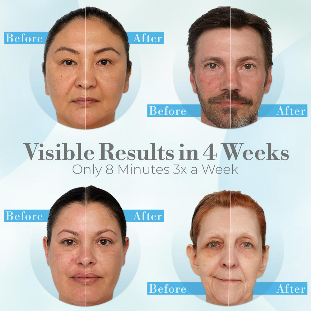 iDerma mask with eyes and mouth coverage for hygienic, even treatment