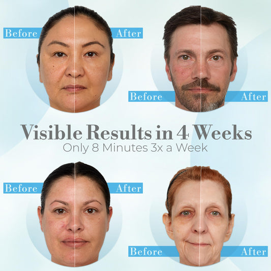 iDerma mask with eyes and mouth coverage for hygienic, even treatment