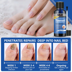 IFUNSHAR close-up of treated nail surface during application.
