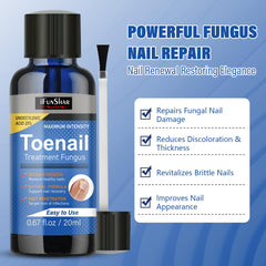 IFUNSHAR after-treatment nails appear smoother and rosier.