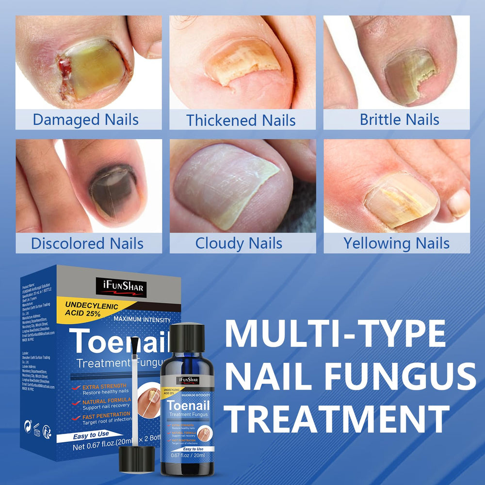 IFUNSHAR close-up of yellowed nails before treatment.