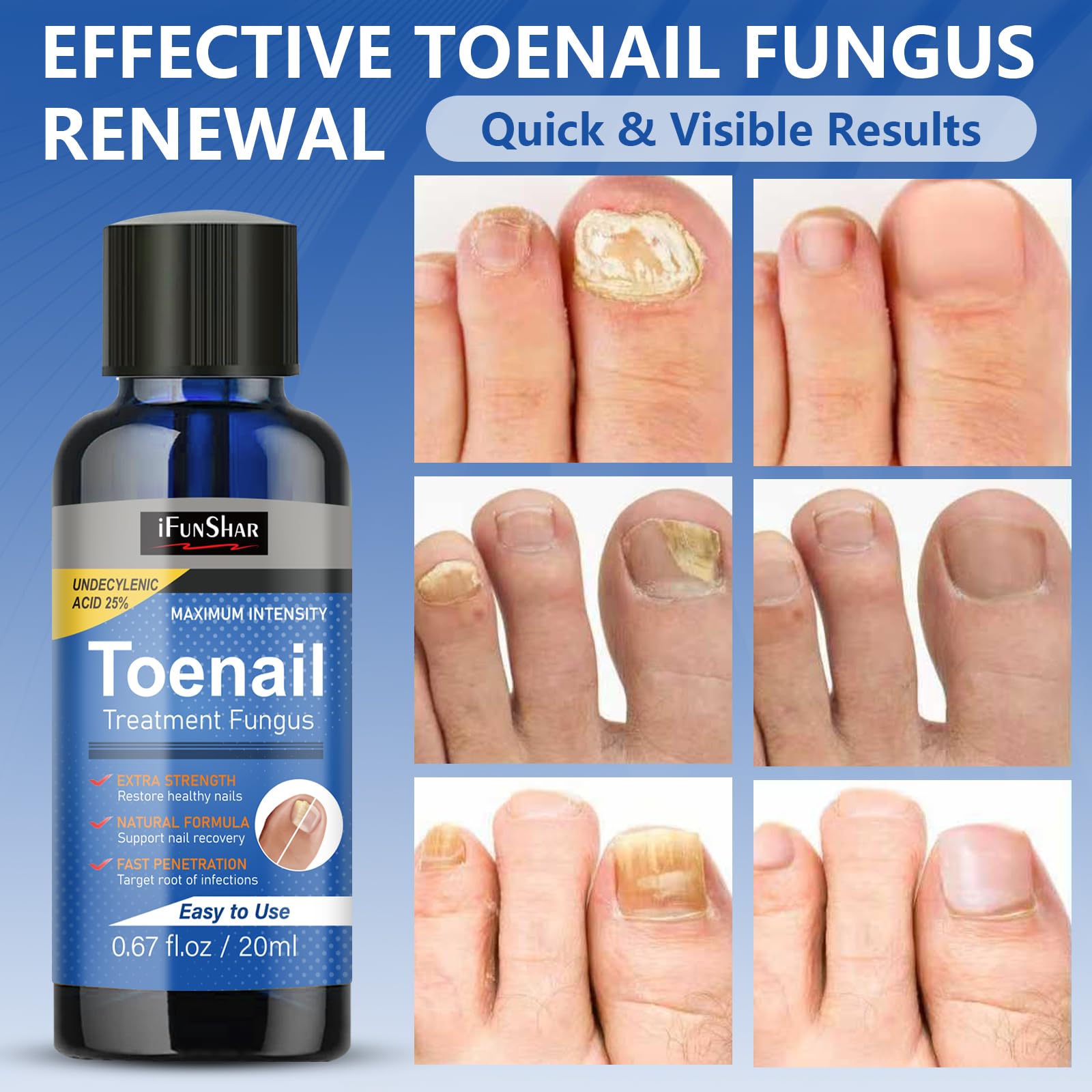 IFUNSHAR two-bottle set ready for routine nail care.