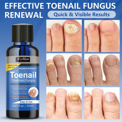 IFUNSHAR two-bottle set ready for routine nail care.