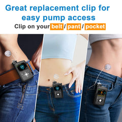 iGuerburn Medtronic clip replacement compatible with ACC-1599 and ACC-1601