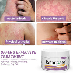 Ishancare Urticaria Cream tube dispensing tip highlights fast acting relief.