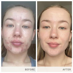 Jane Iredale Skin Accumax closeup capsules ready for daily use