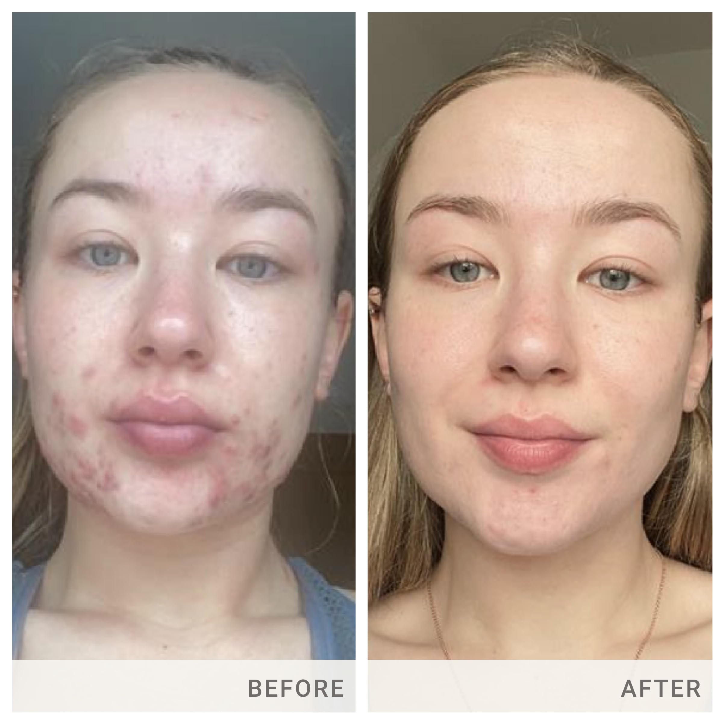 Skin Accumax label features patent-pending vitamin blend for skin care.