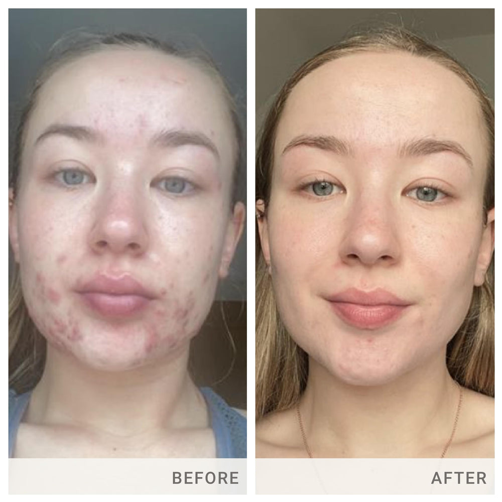 Skin Accumax label features patent-pending vitamin blend for skin care.