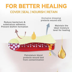 Individually sterile Jointown Xeroform dressing packaging for portability