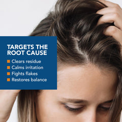 Kenkoderm psoriasis conditioner used on scalp for gentle care
