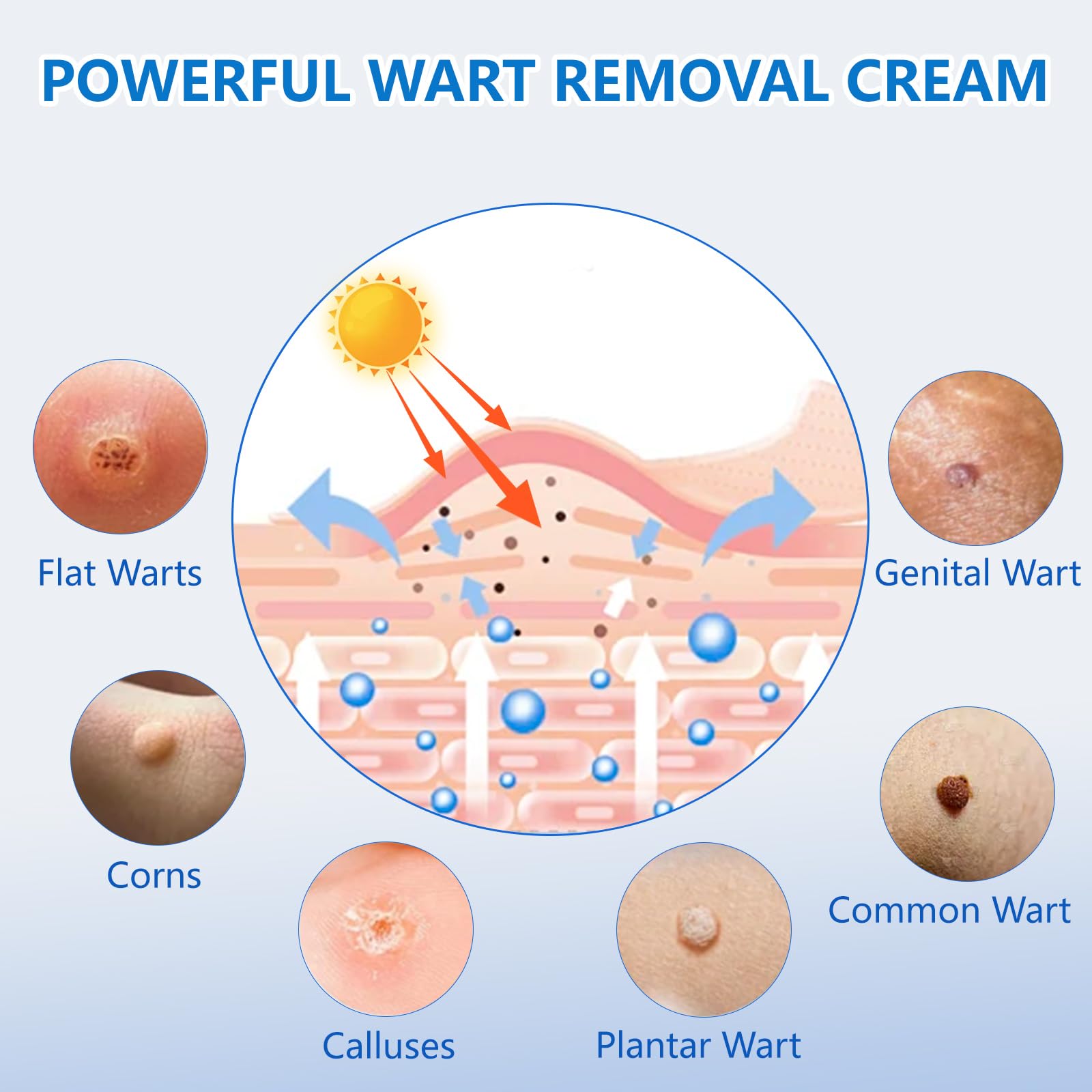 KIbabyDI freeze-off technology graphic illustrating rapid wart action and at-home treatment