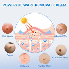 KIbabyDI freeze-off technology graphic illustrating rapid wart action and at-home treatment