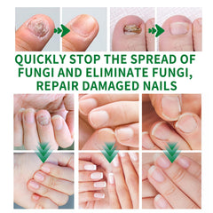 KUNLEN Multi-Purpose Nail Oil Serum bottle closeup demonstrating nourishment for nails.