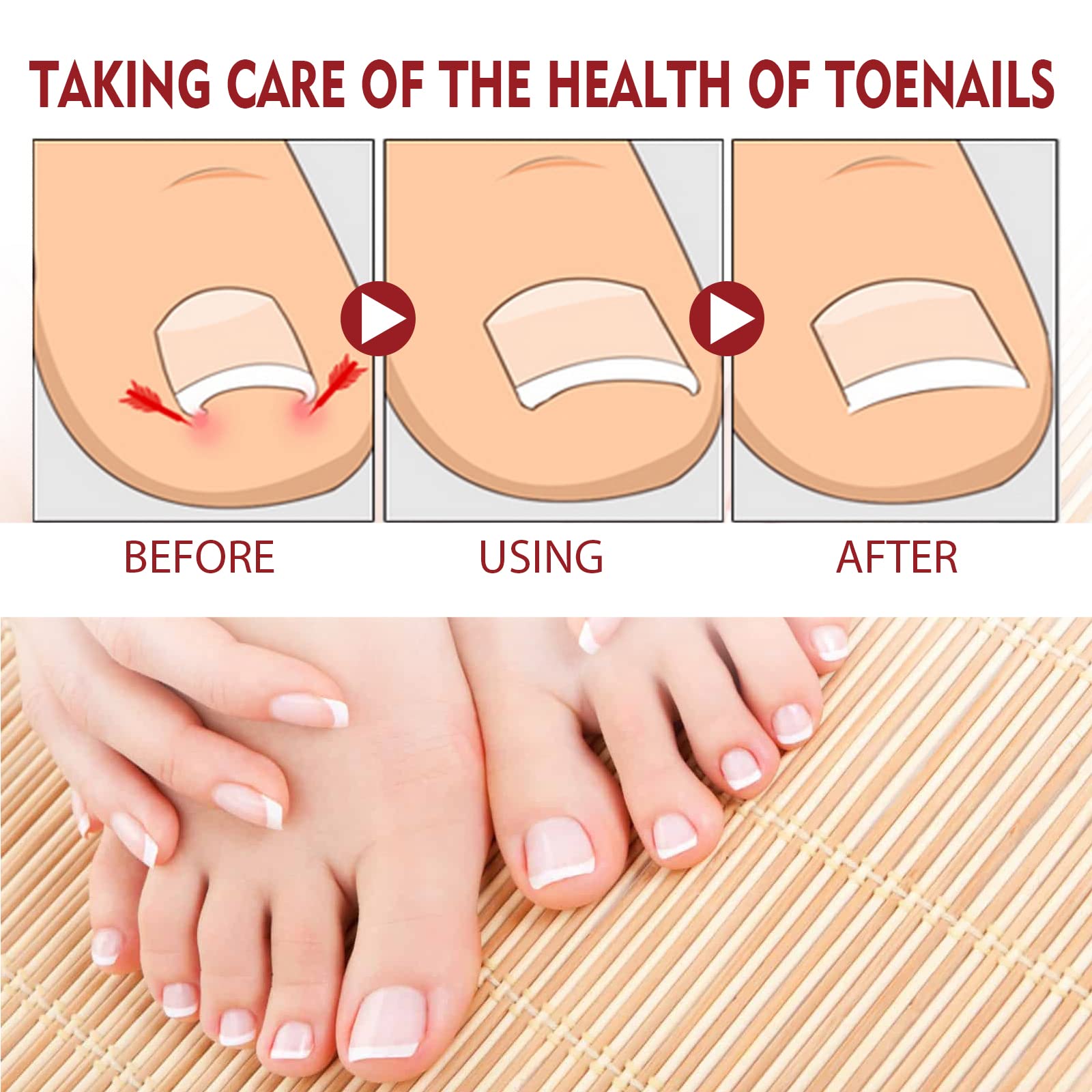 KUNLEN Nail Growth Gel application scene showing massage for absorption.