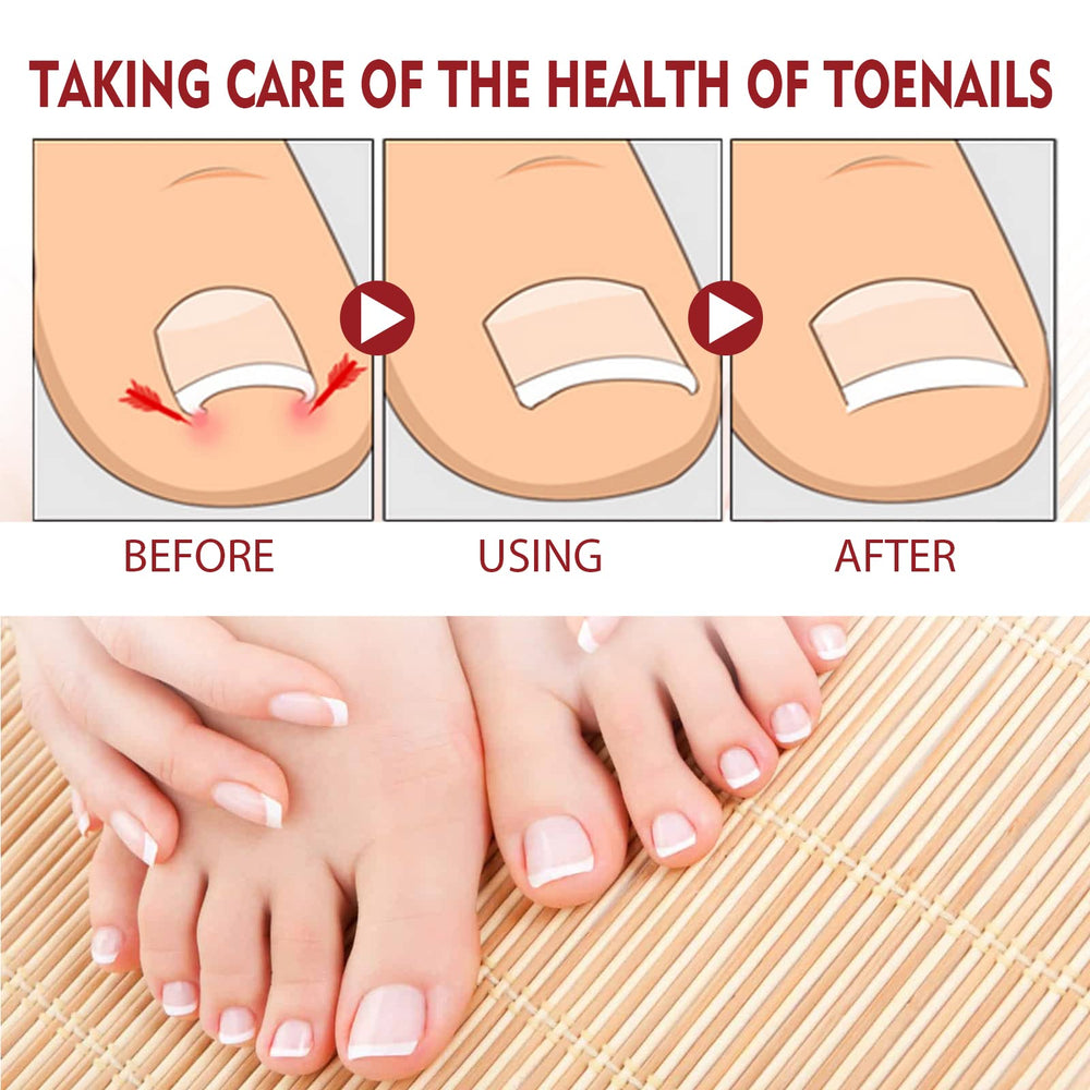 KUNLEN Nail Growth Gel application scene showing massage for absorption.
