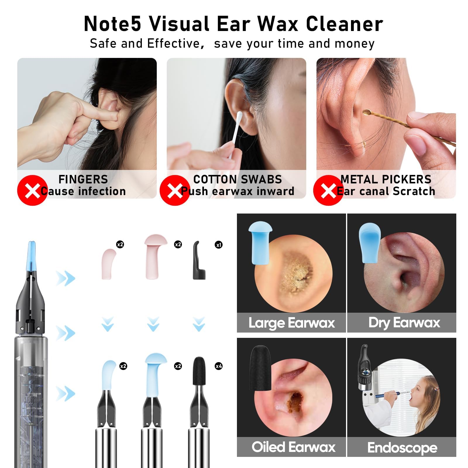 KWYBOW Note5 ear scoops offer versatile cleaning options for different needs.