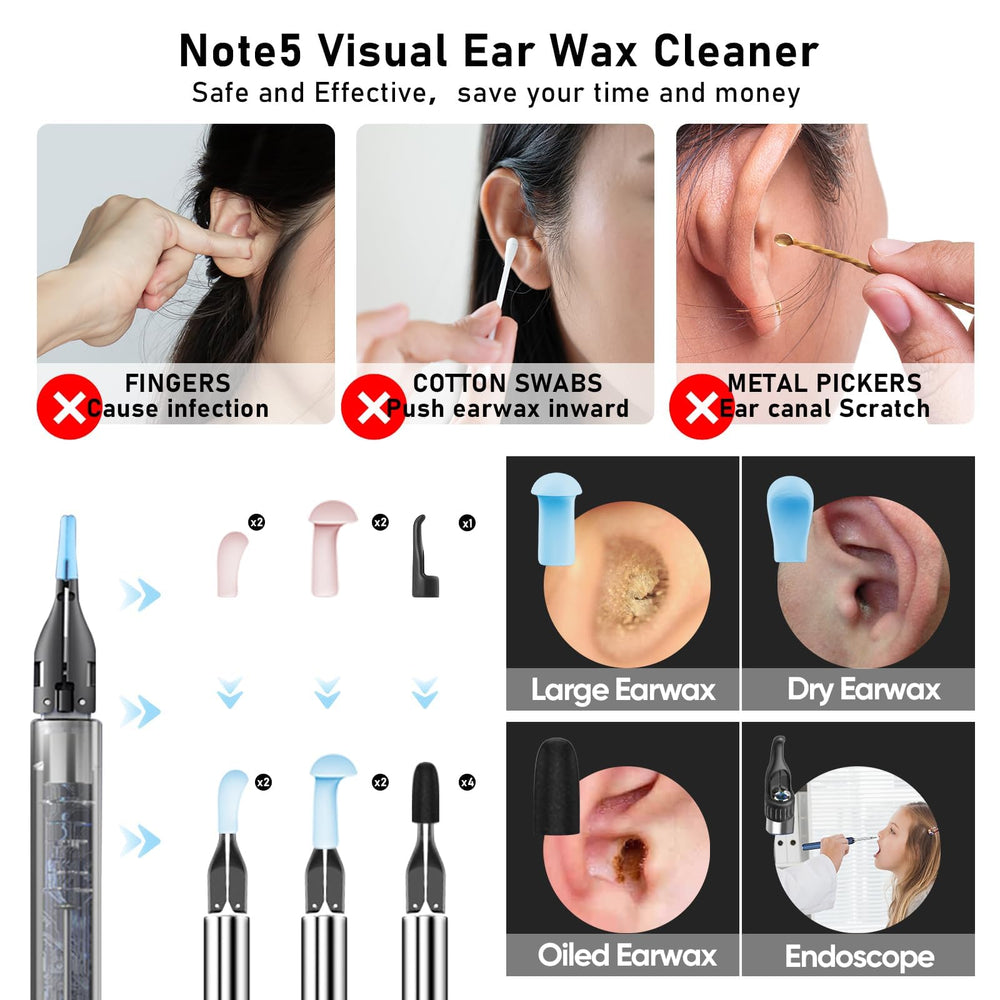 KWYBOW Note5 ear scoops offer versatile cleaning options for different needs.