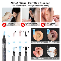 KWYBOW Note5 ear scoops offer versatile cleaning options for different needs.