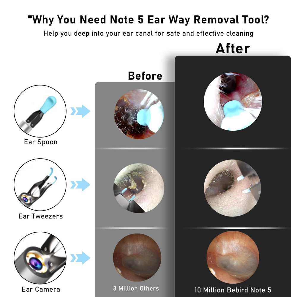 KWYBOW Note5 compact endoscope with 3.2 mm diameter for comfortable use.