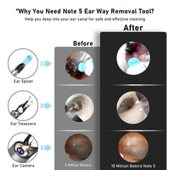 KWYBOW Note5 compact endoscope with 3.2 mm diameter for comfortable use.