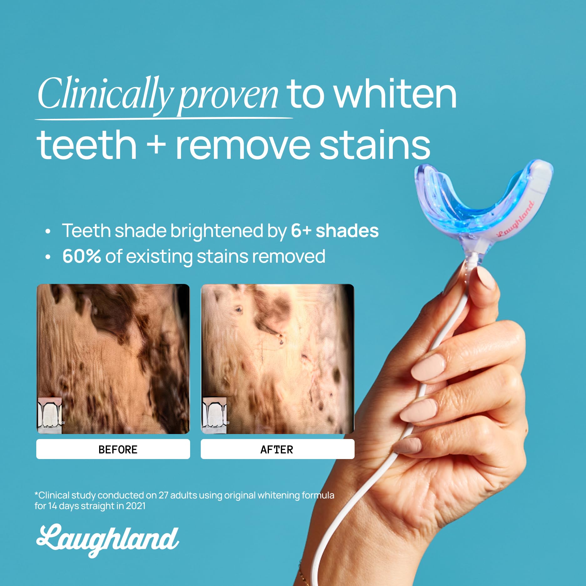 Laughland sensitivity-friendly formula designed for comfortable whitening.