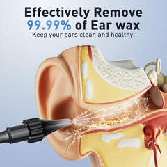 Lebbtl 1080p ear camera with LED lights for detailed viewing