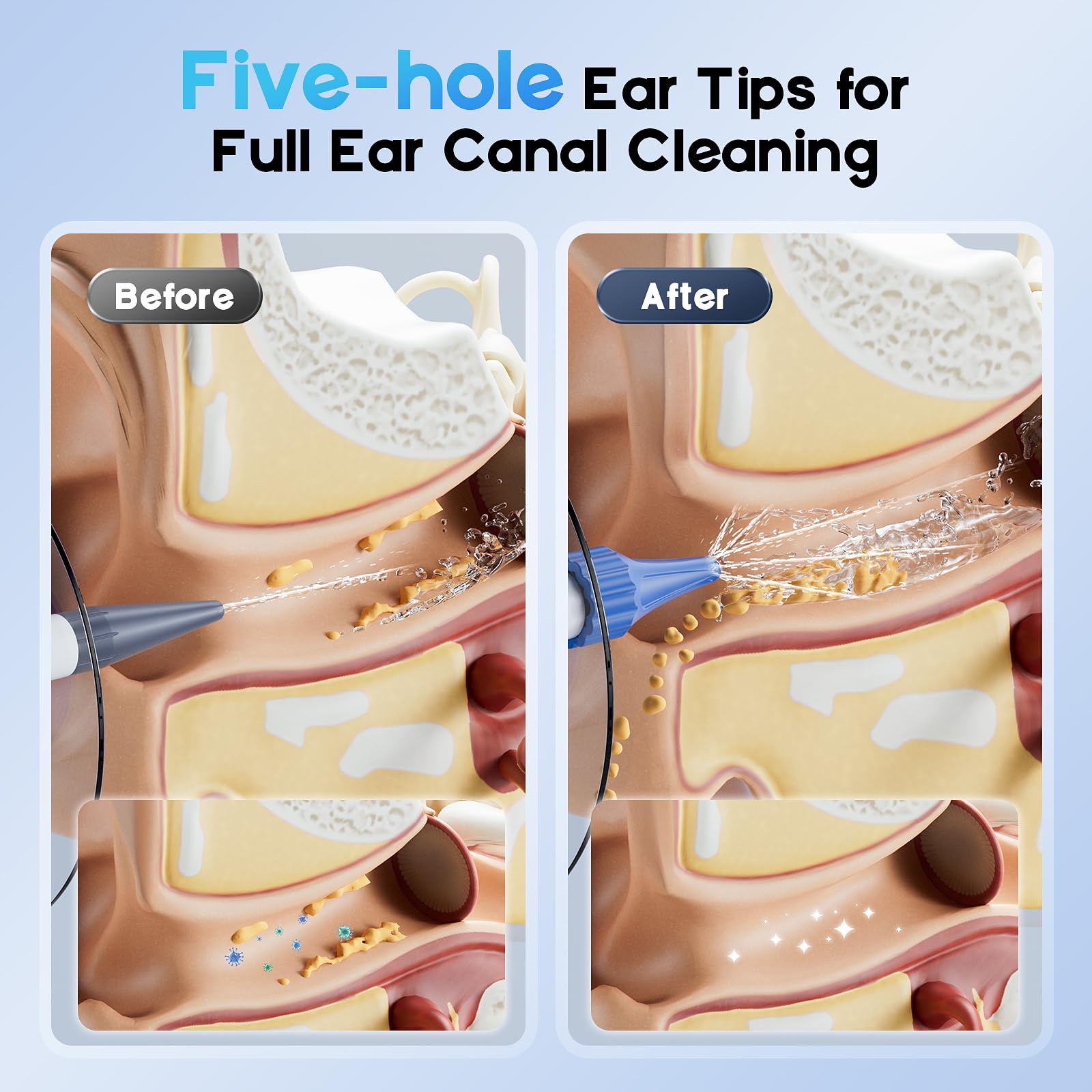 Lebbtl Five-Hole Stream demonstrates gentler multi-channel flush for thorough cleaning.