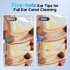 Lebbtl Five-Hole Stream demonstrates gentler multi-channel flush for thorough cleaning.