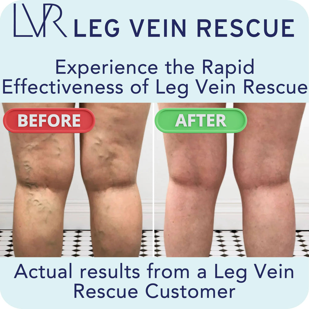 LEG VEIN RESCUE Diosmin bottle label highlights ingredients and benefits.