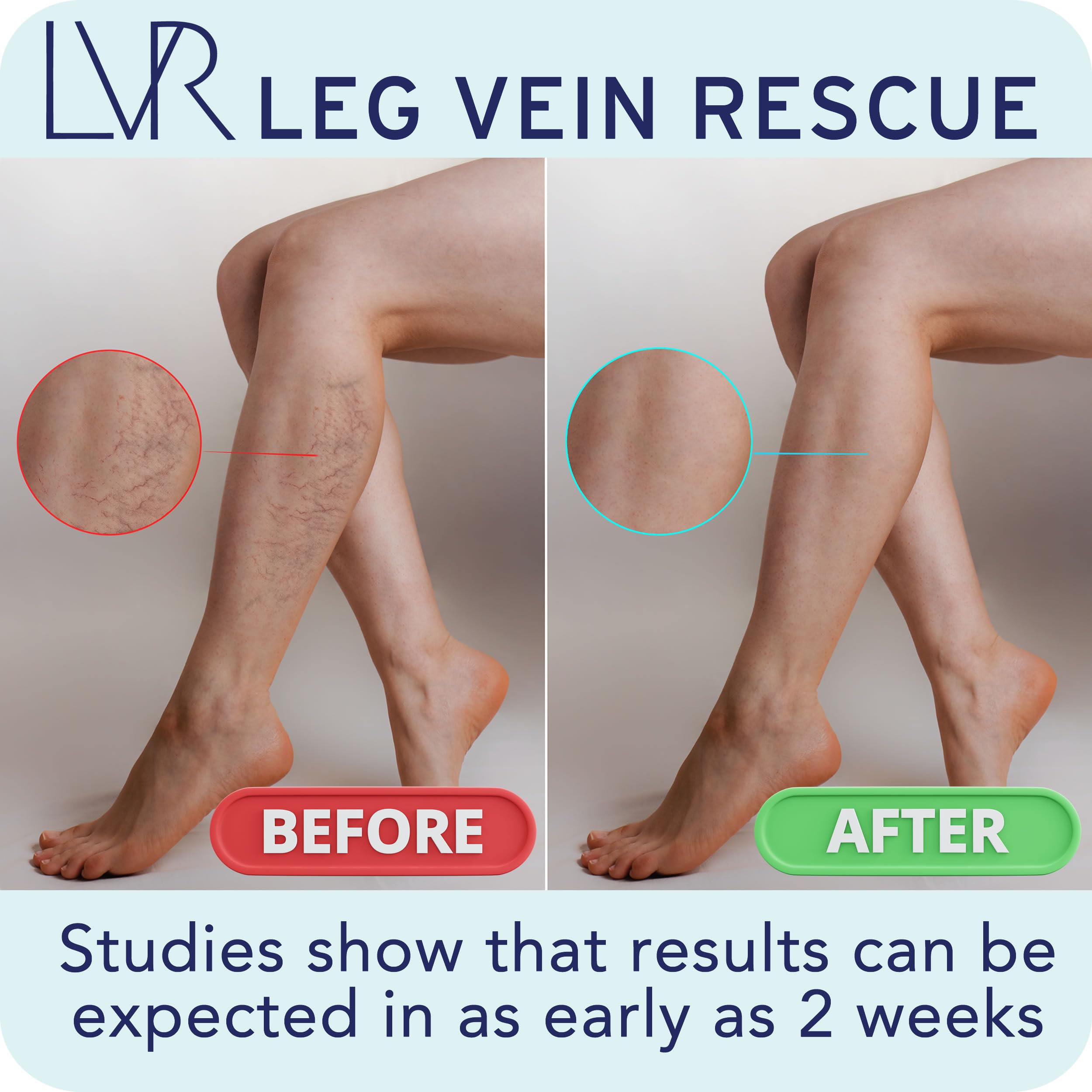 LEG VEIN RESCUE Diosmin capsules in hand.