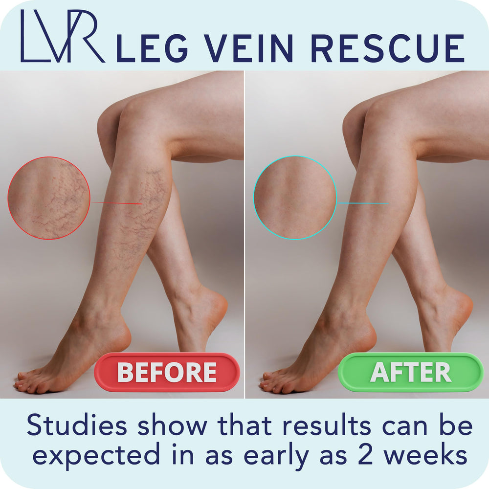 Visual of leg vein comfort with LEG VEIN RESCUE vein support concept.