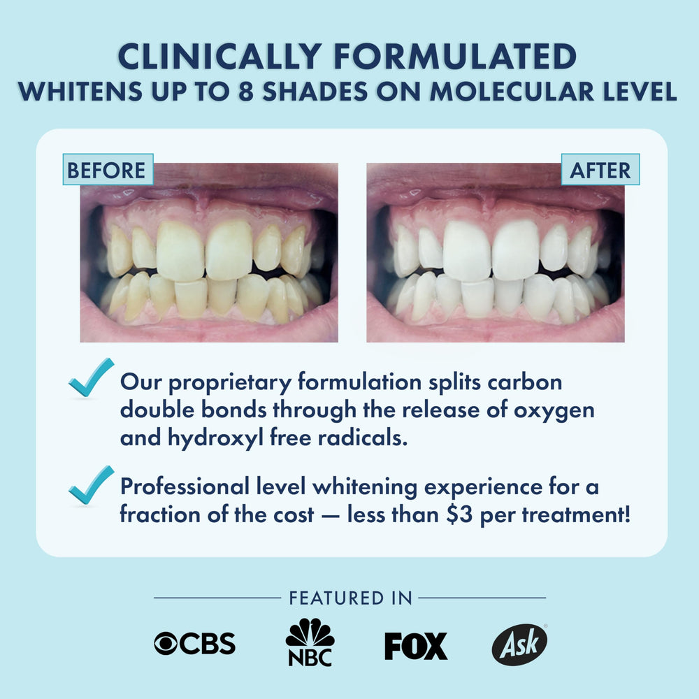 LIVFRESH strip being applied to teeth for gentle whitening.