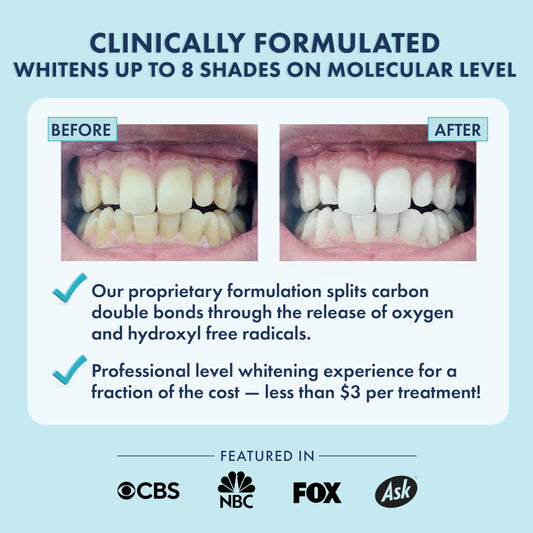 LIVFRESH strip being applied to teeth for gentle whitening.