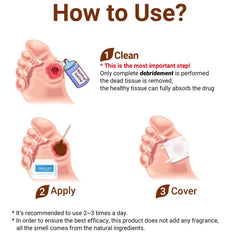 LMNOOP application on skin demonstrates direct topical use for fast care.