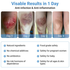 LMNOOP Wound Care Ointment addressing bedsores with natural ingredients for targeted care