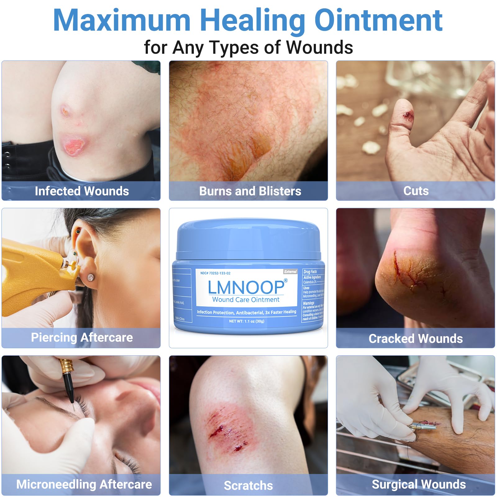 LMNOOP Wound Ointment on burns and surgical sites offering soothing support
