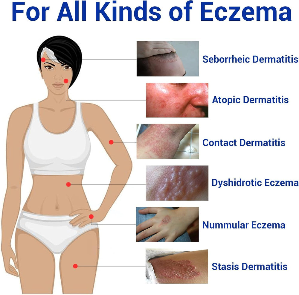 LMNOOP Eczema Cream application on arm demonstrates gentle glide