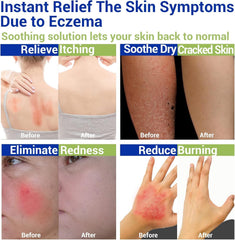 LMNOOP Eczema Cream texture close-up highlighting smooth absorbs quickly