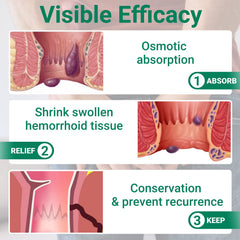 LMNOOP hemorrhoid ointment skin protection focuses on gentle perianal care.