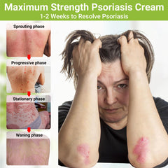 LMNOOP Psoriasis Cream jar texture indicating non greasy, deep moisturization