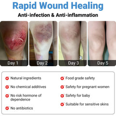 LMNOOP Wound Healing Cream used in home first aid scenarios.